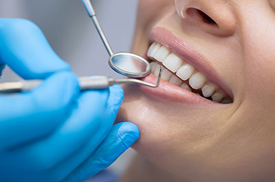 The image shows a person with their teeth being attended to by a dental professional using a dental tool, likely in a dental office setting.