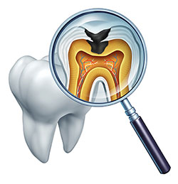 The image features a magnified view of a human tooth with an open crown, illustrating its internal structure and dental pulp, viewed through a magnifying glass with an X-ray image superimposed on the glass showing the root canal system.
