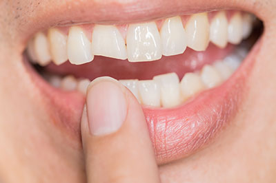 The image shows a close-up view of a person s hand holding a toothbrush near an open mouth with teeth, where one can see a toothpaste smear on the lower lip, suggesting recent oral hygiene activity.