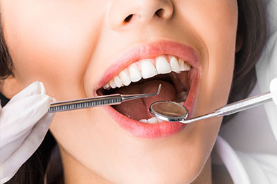 Woman with open mouth showing teeth, surrounded by dental instruments, including tweezers and spoon-like tools, suggesting a dental care setting.