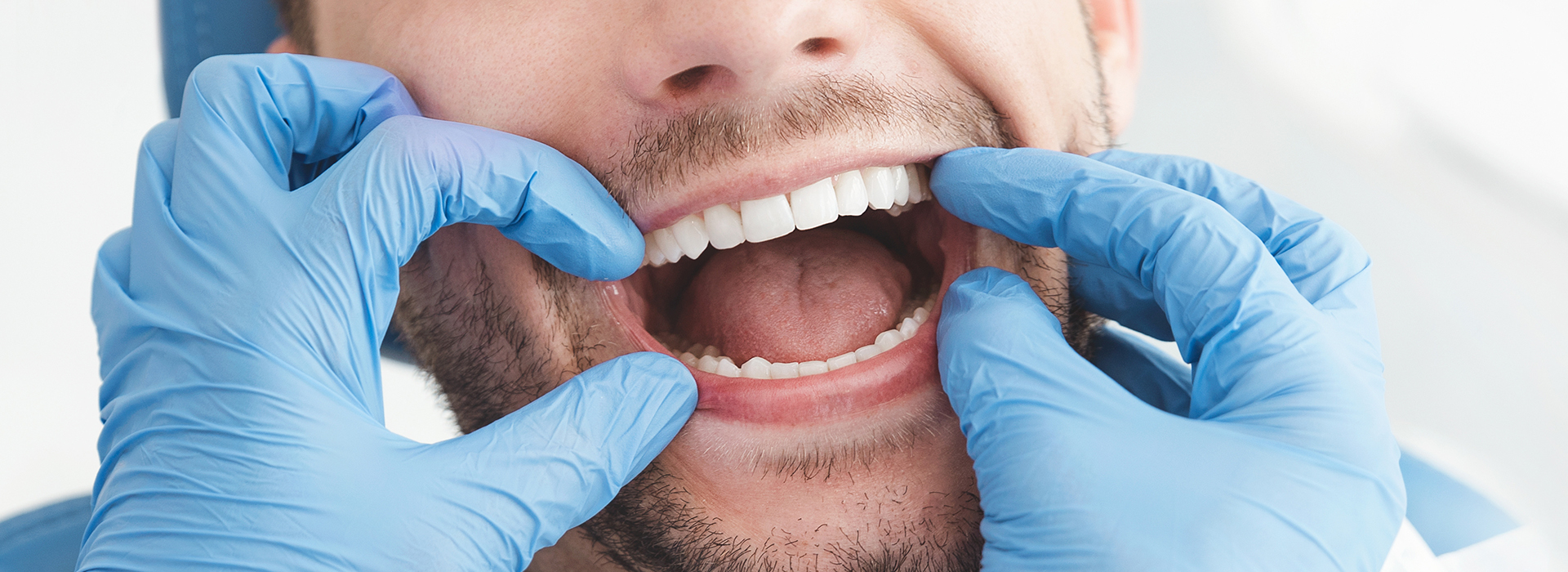 A man wearing blue gloves holds his mouth open with both hands while sitting in a dental chair.