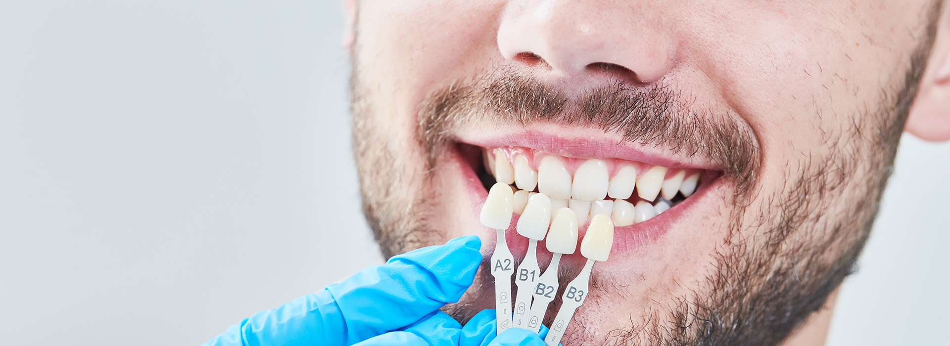 The image shows a man with a toothy smile, wearing a white lab coat and blue gloves, holding a dental implant with a white crown attached to it, while looking directly at the camera.